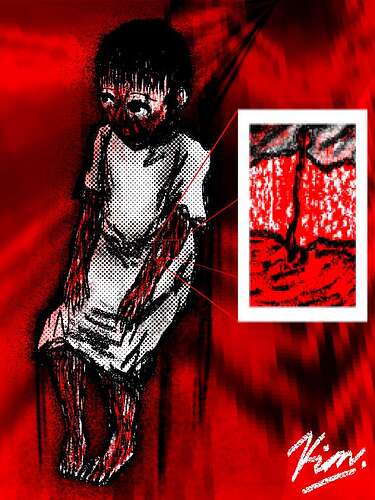 Lacerations_20250927074018